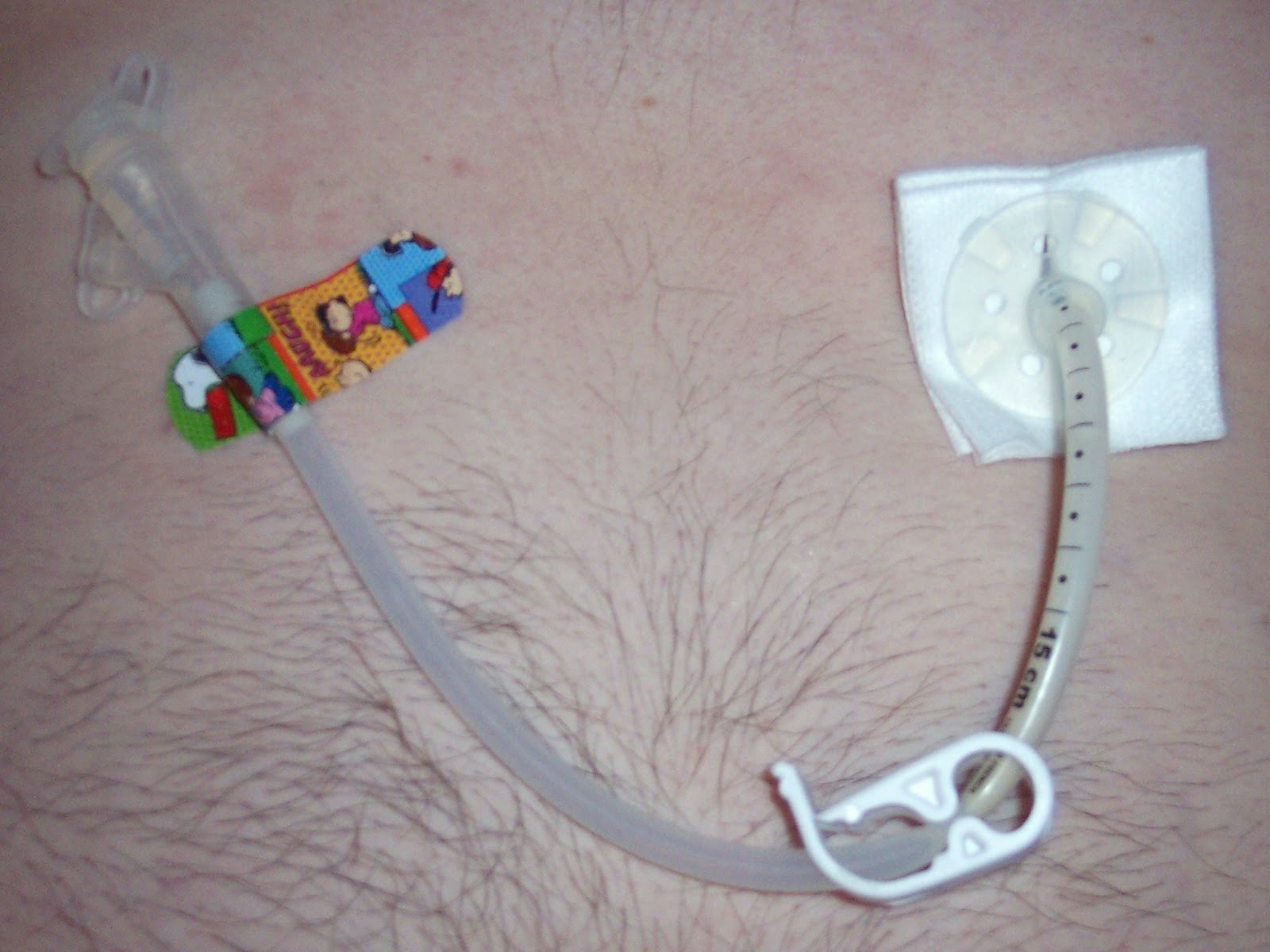 FMR Fat Man Running July 2010