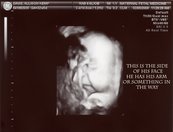 [ultrasound2.jpg]