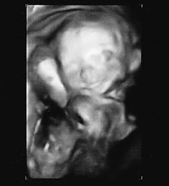 Danish-American Baby