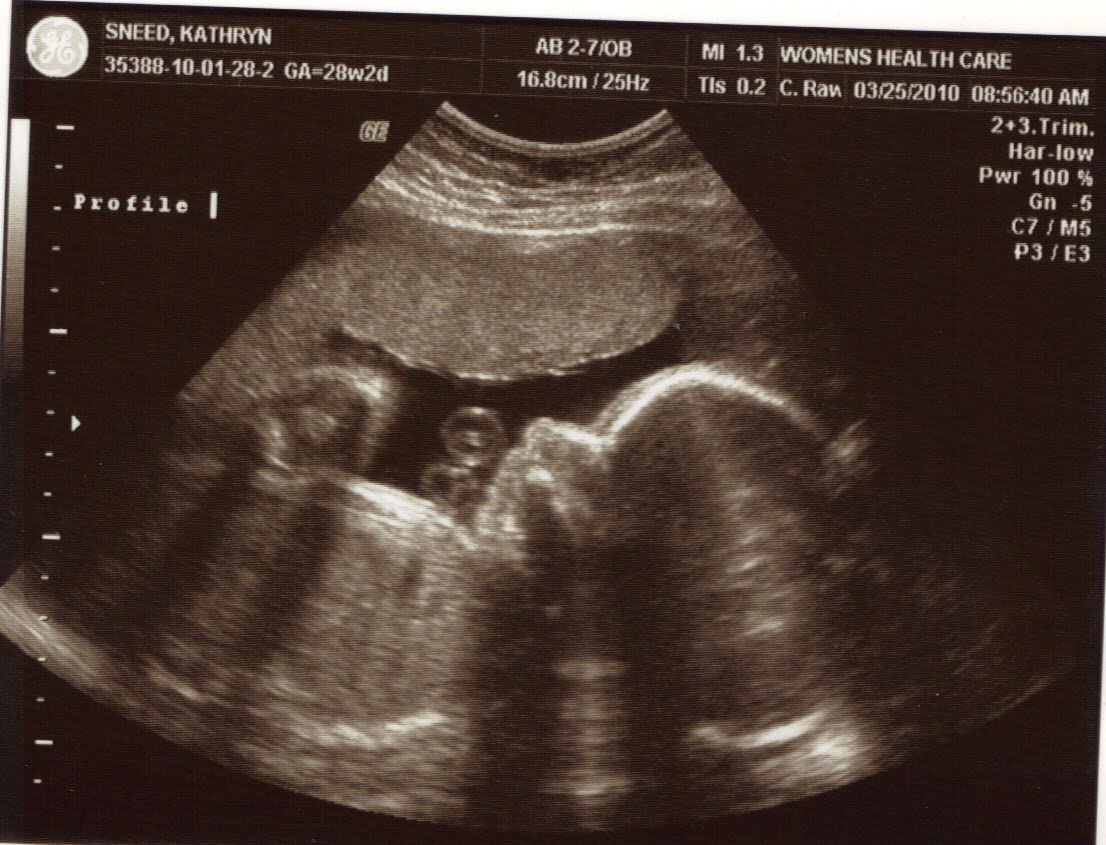 Pregnancy: Week 28 Ultrasound/Heart Check | Singing ...