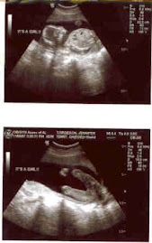 Heidi Ultrasound - 19 weeks