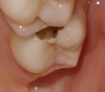 [tooth2.JPG]