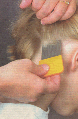 The Nice Lice Lady How To Remove Head Lice From Someone Else