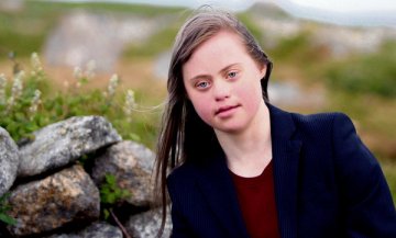 Expectancy graph average lifespan renaissance chart care health diminishing returns law healthcare simple years perspective interesting applied living darn expensive Media dis&dat: Teen with Down syndrome wins student of the year award