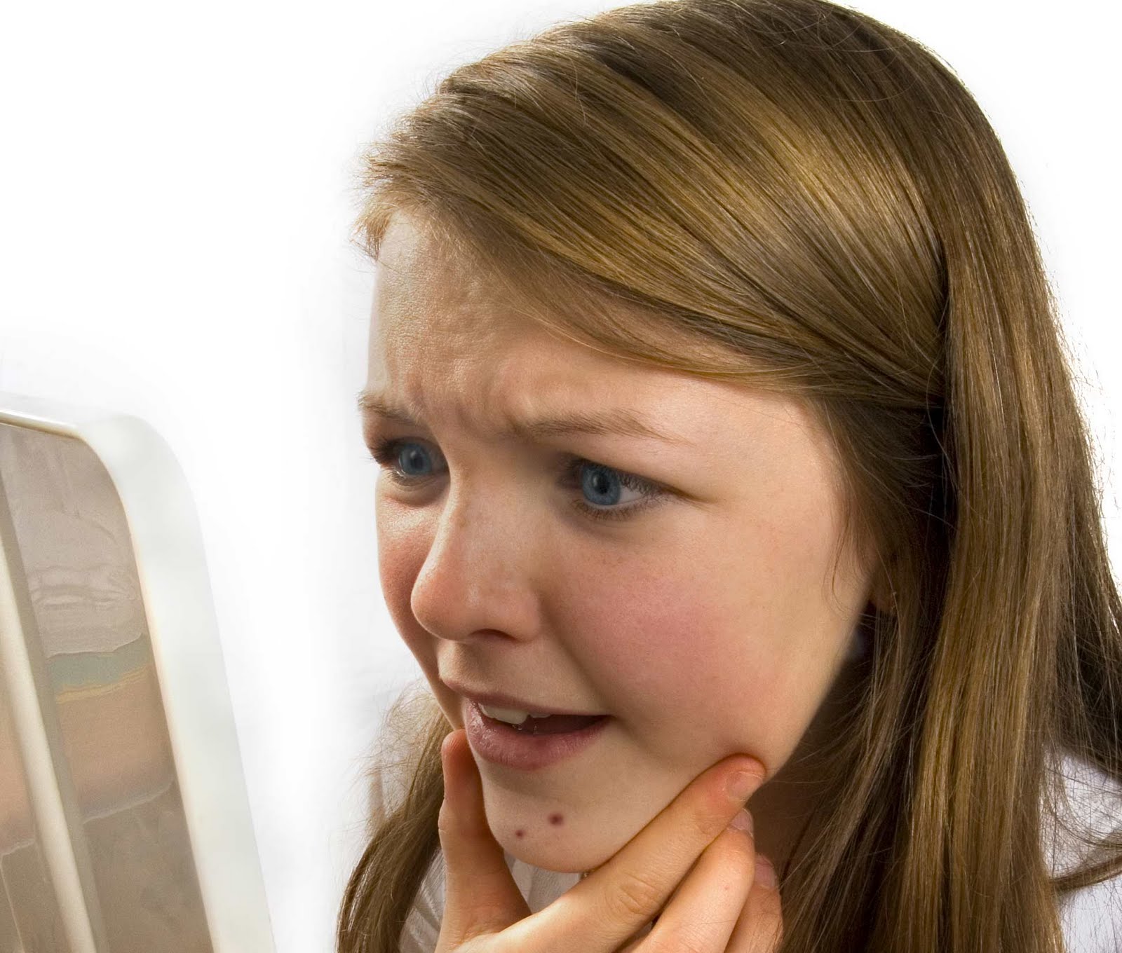 Acne Bad