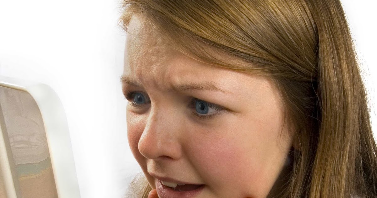 Smoker's acne Causes of pimples drugs and acne and popping pimples