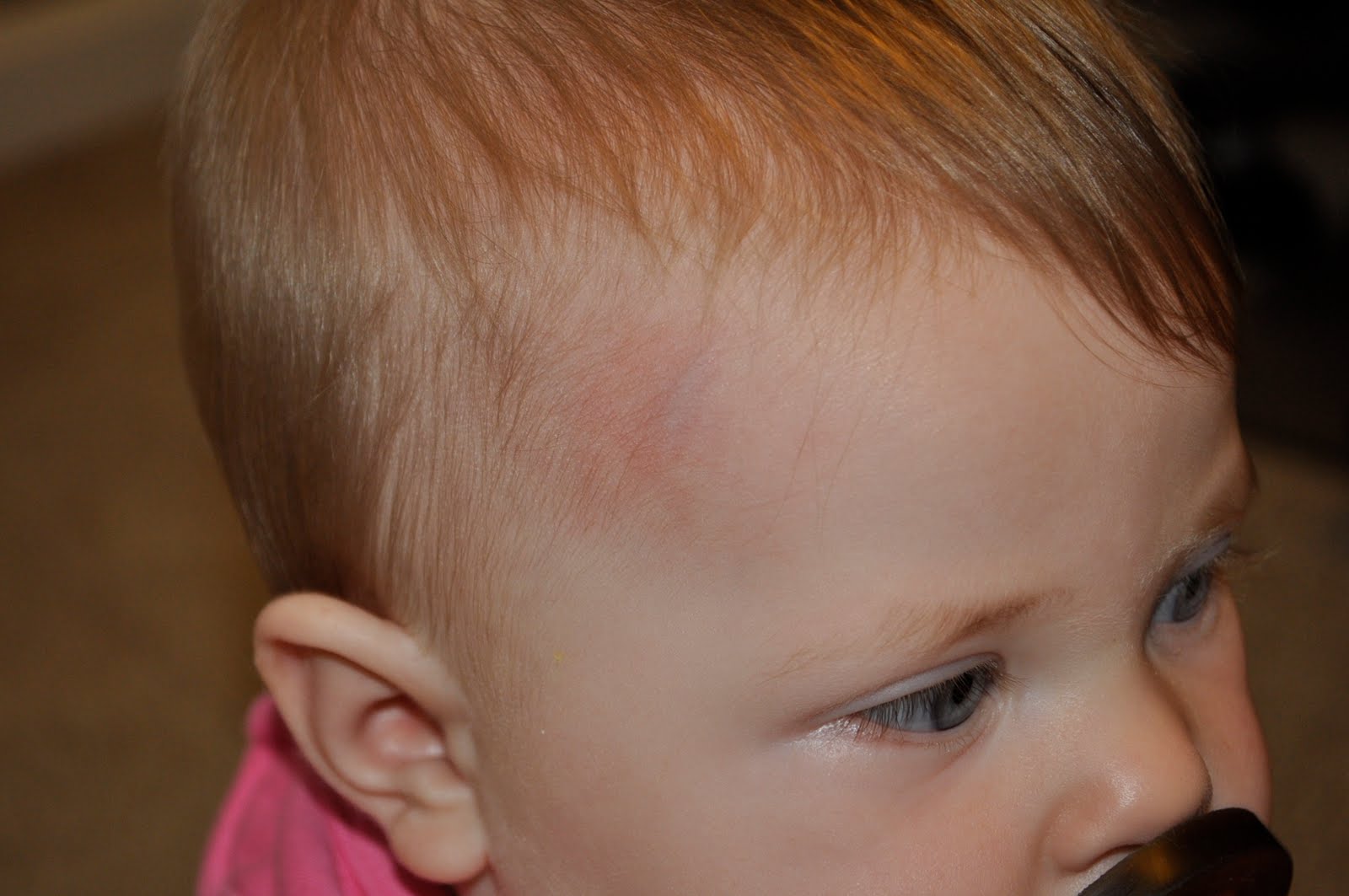 Ramblings Of The Ribble Family Head Bump