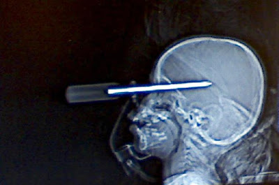 http://3.bp.blogspot.com/_R9koLY5zVWo/S4fzCjQzhQI/AAAAAAAAEIg/3ZKfsdNT9K0/s400/screw.jpg