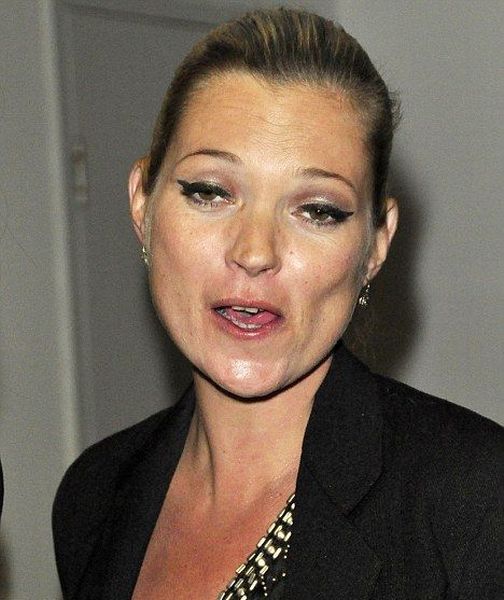 Bad Looking Celebrities