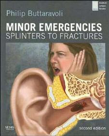 Minor Emergencies. Splinters to Fractures