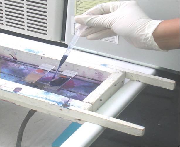 malaria stain