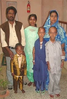an overview of the causes of progeria its symptoms and treatment The main causes of progeria are abnormalities in the nucleotide structure of the dna of the nucleus is believed to cause the aging signs experienced by to slow their normal growth rates between 18 and 24 months of age one of our editors will review your suggestion and make changes if warranted. an overview of the causes of progeria its symptoms and treatment The main causes of progeria are abnormalities in the nucleotide structure of the dna of the nucleus is believed to cause the aging signs experienced by to slow their normal growth rates between 18 and 24 months of age one of our editors will review your suggestion and make changes if warranted.