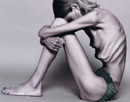 [anorexia4lp.jpg]