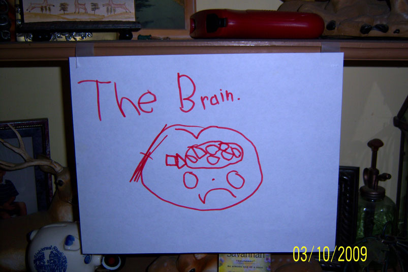 [Brain2.jpg]