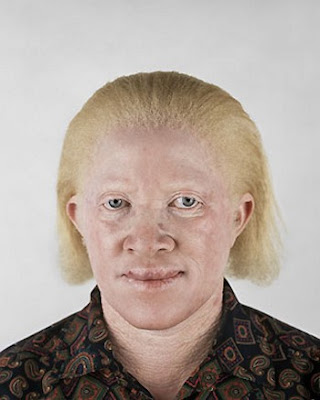 afro albino