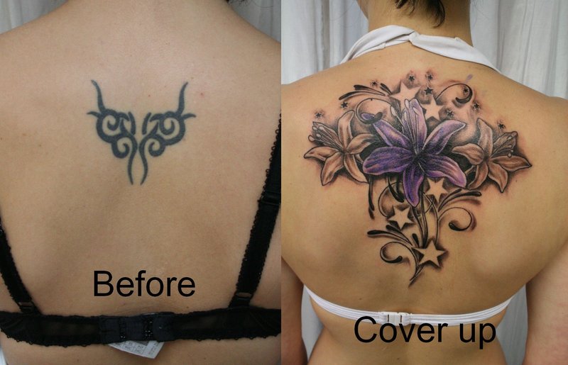 Tattoo is a permanent mark on the body for life However it can be removed