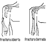 El cirujano vascular el miembro viril