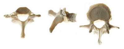 Huesos irregulares (vértebras)
