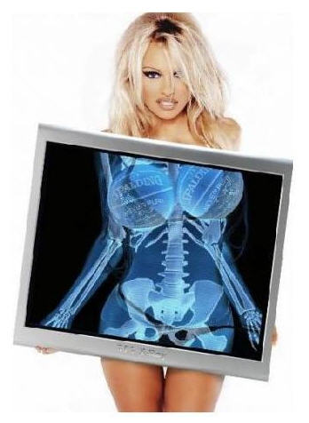TSA Leaks Pamela Anderson's Naked Full Body Scan