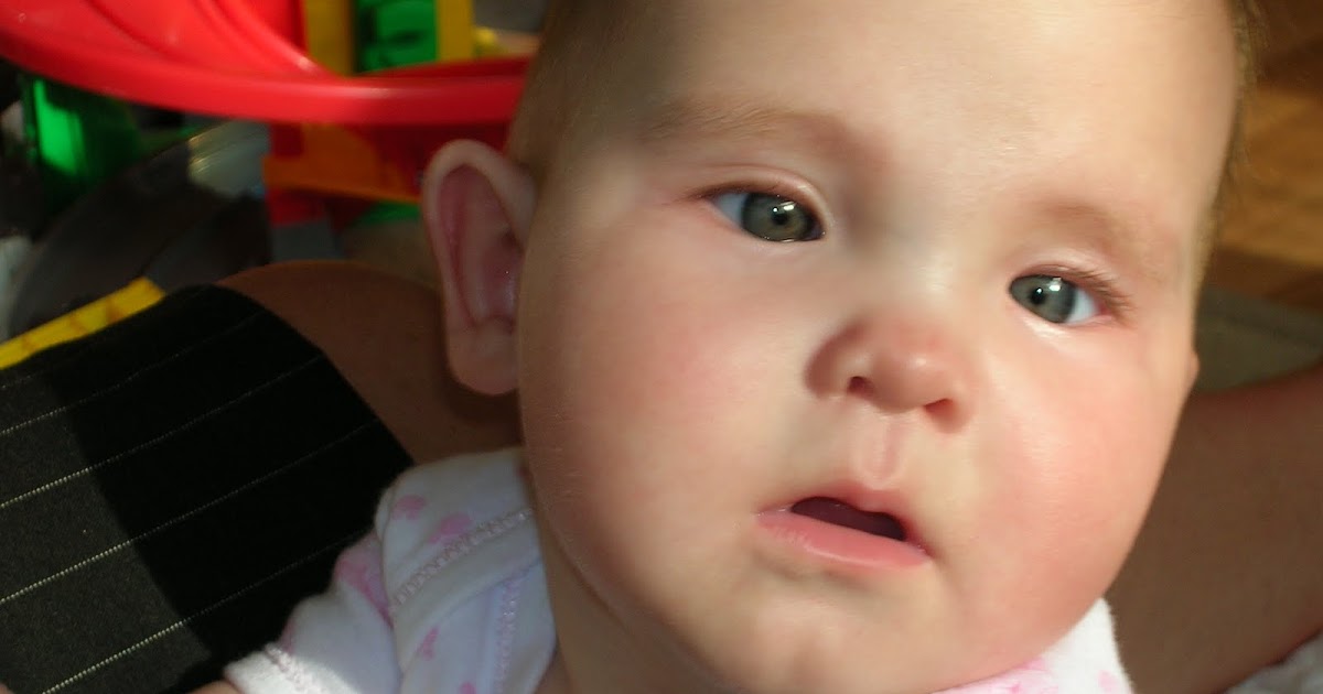 EMILY JEAN and KOOLEN DE VRIES SYNDROME [formerly 17q21.31 microdeletion syndrome] Nystagmus......