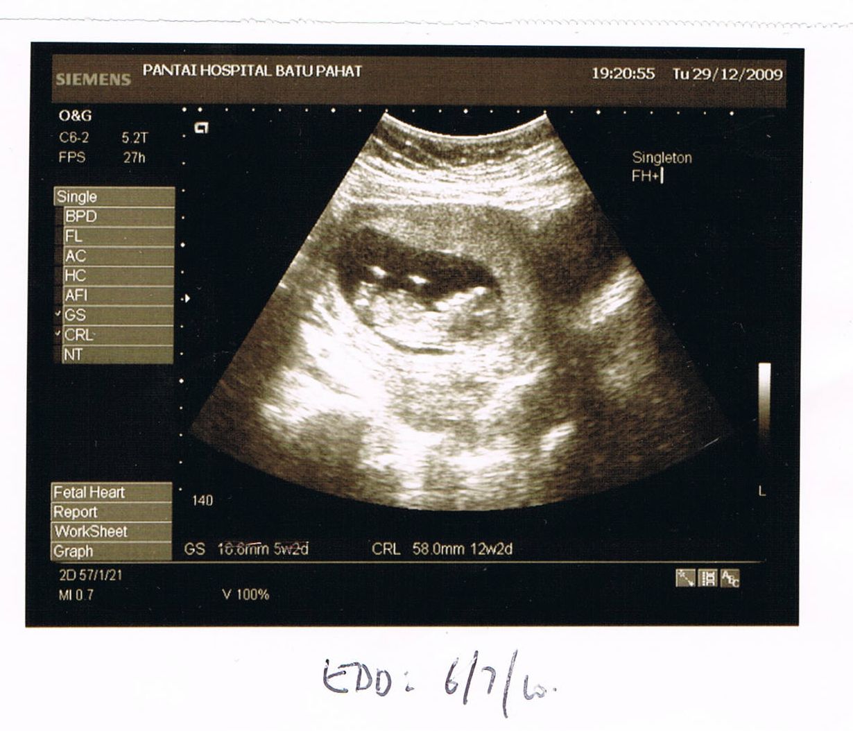 [CCF12302009_00001.jpg]