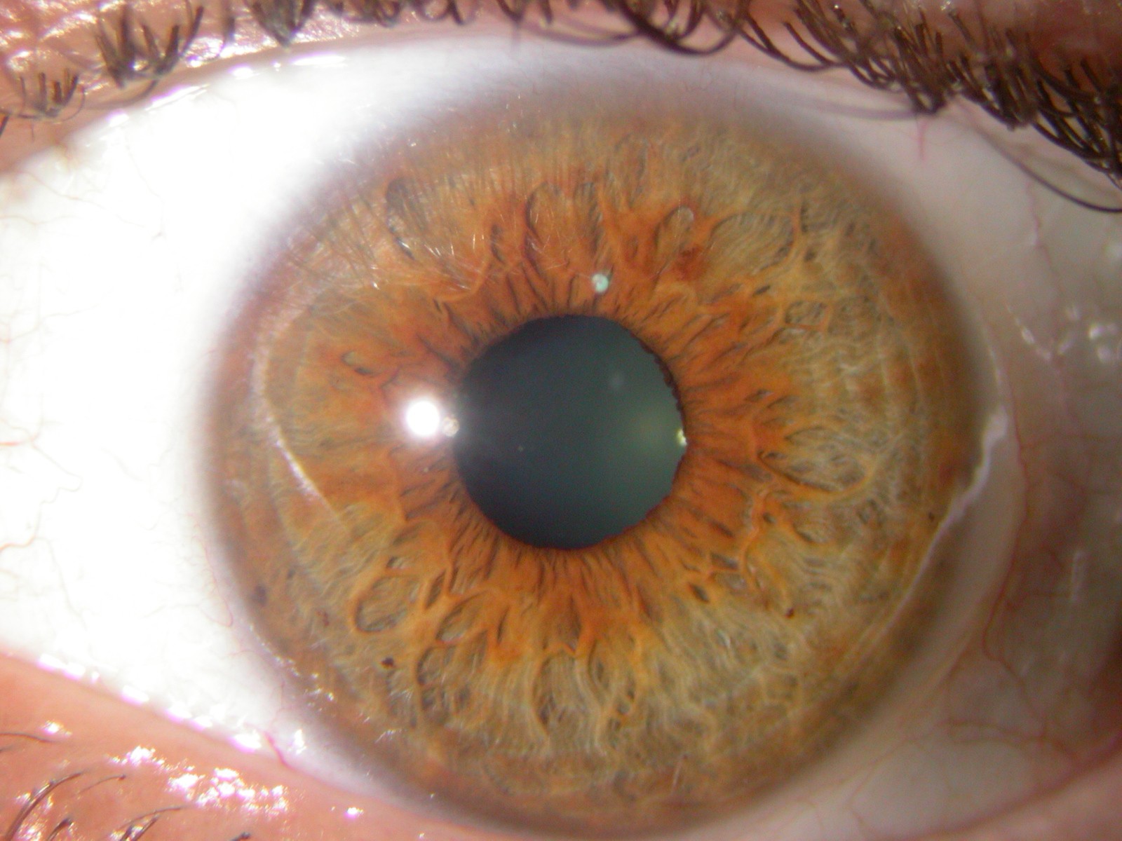 Eye Colors: Iridology Iris Pictures
