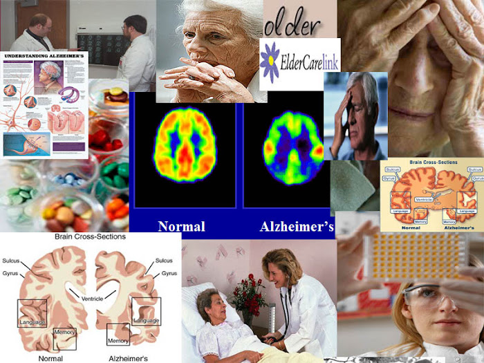 Alzheimer's Disease Collage