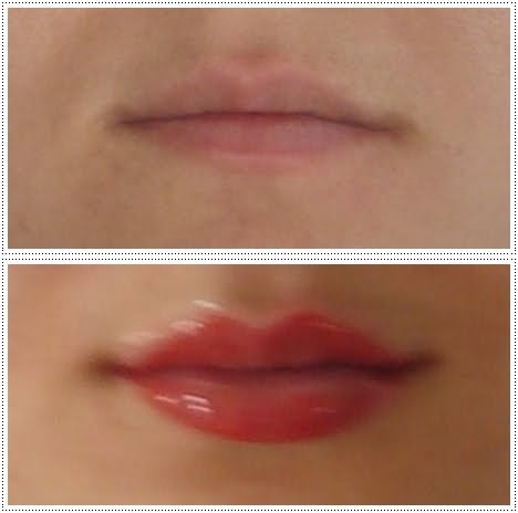 lábios  antes  e depois