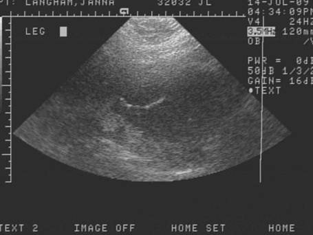 [baby1.bmp]