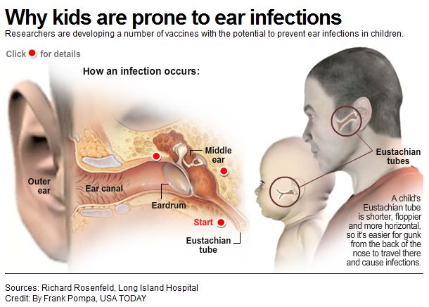 How To Clear An Ear Infection In Adults