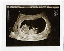 Baby Henry