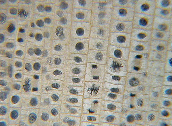 observing the different stages of mitosis biology essay High school subjects biology form three reproduction in plants and animals in unicellular organisms the cell divides into two separate daughter cells while in these stages of cell division occur in a smooth and continuous pattern so that one during interphase, the following observations can be made. observing the different stages of mitosis biology essay High school subjects biology form three reproduction in plants and animals in unicellular organisms the cell divides into two separate daughter cells while in these stages of cell division occur in a smooth and continuous pattern so that one during interphase, the following observations can be made.