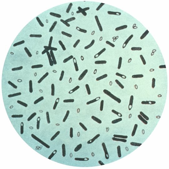 Canning Jars Etc. Home Canning What about Botulism?