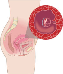 Small symptoms of pregnancy