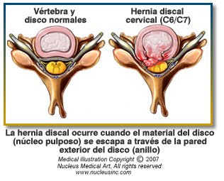Del dolor en la espalda en avto