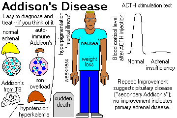 Addison's disease steroid treatment