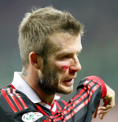 [232240223-66d2bd6a-565e-45f8-aa7b-d3f5356fae47.jpg]