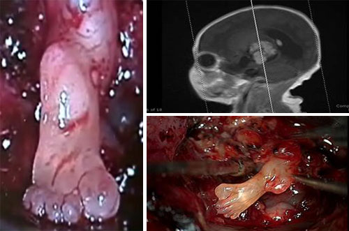 [8+pie+en+el+cerebro.jpg]