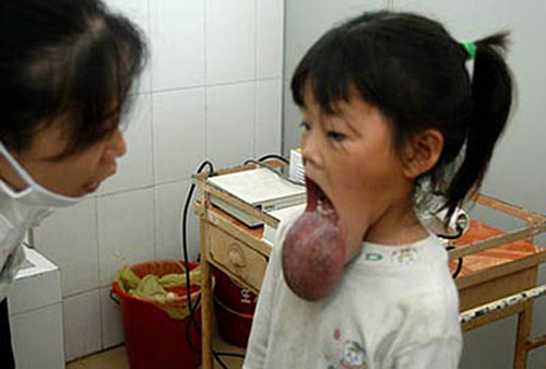 [15+tumor+labio.jpg]