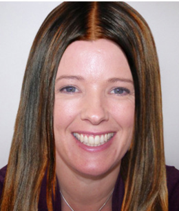 neve cbell latest news fergie hair loss hair styles fergie her hair loss hair neve cbell latest news fergie hair loss hair styles fergie her hair loss hair