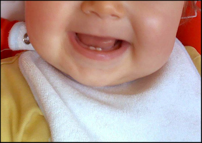 [dentinhos.jpg]