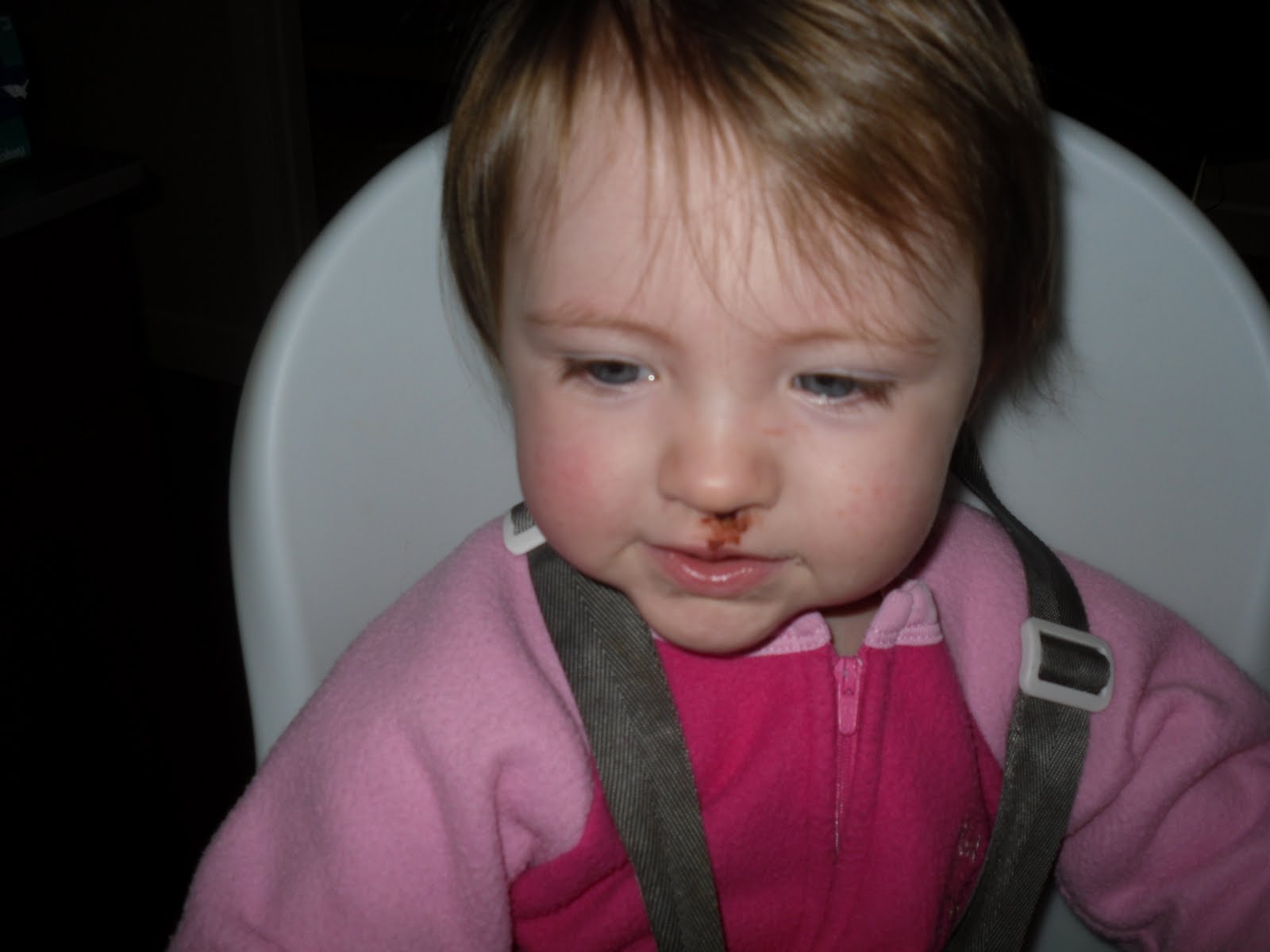 The Kelly Kids Caroline 20monthsFirst busted lip