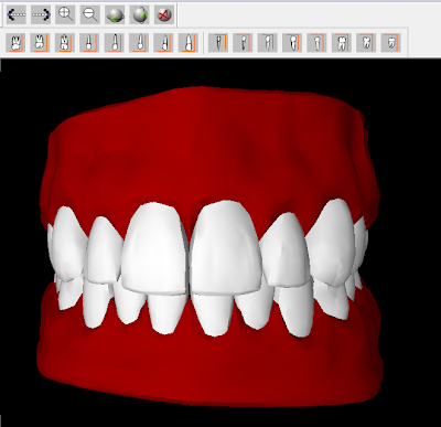 البرنآمج الرآئع في الـ | Programa Simulador 3D de Anatomia Dental || Dental Anatomy || Anatomia+dental+3d