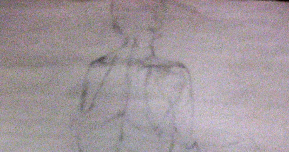 Life Drawing One: Shoulder Blades