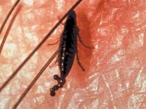 Insetti Sul Mio Cane Aiuto Cane