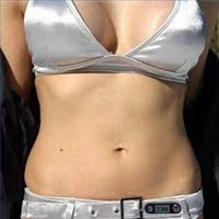 Girl in silver bikini top with lopsided breasts