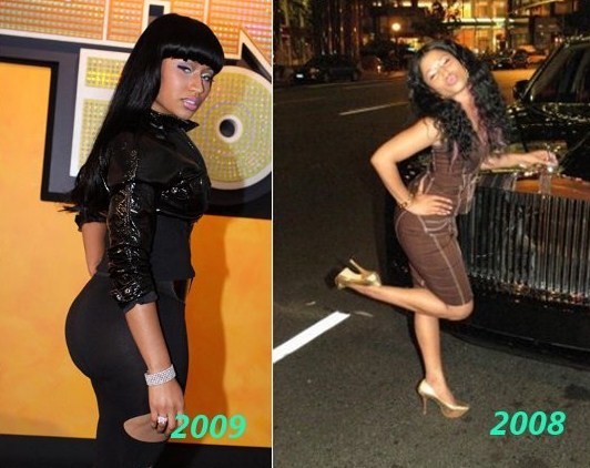 nicki minaj before surgery images. nicki minaj pictures efore