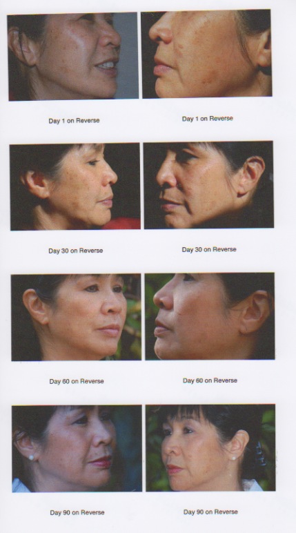 Rodan Fields Reverse