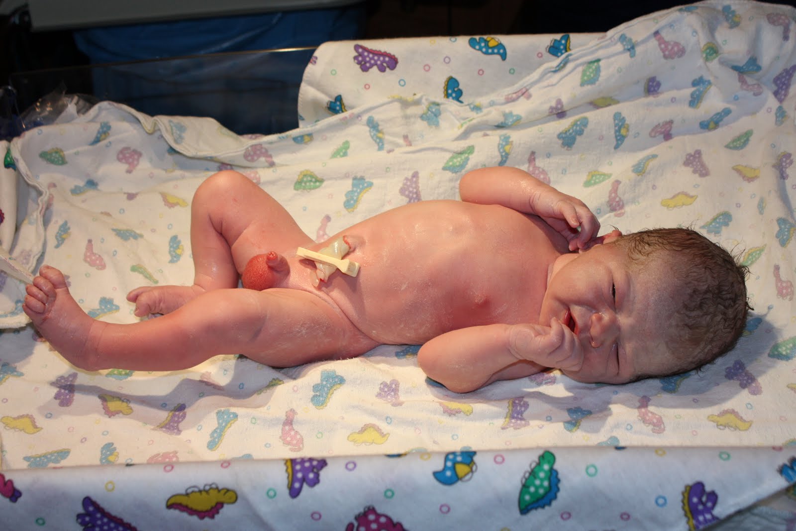 How+big+is+10+centimeters+dilated