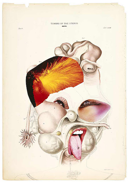 Artist: Wangechi Mutu, Tumours of the Uterus